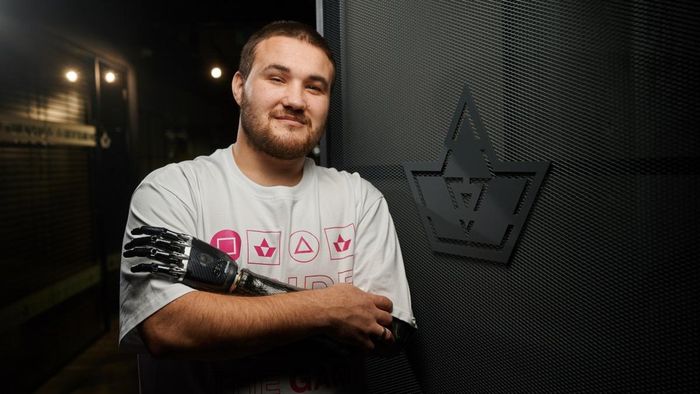 Акція "Кіберпанк 2023" FAVBET допомогла захиснику Бахмута отримати сучасний біонічний протез