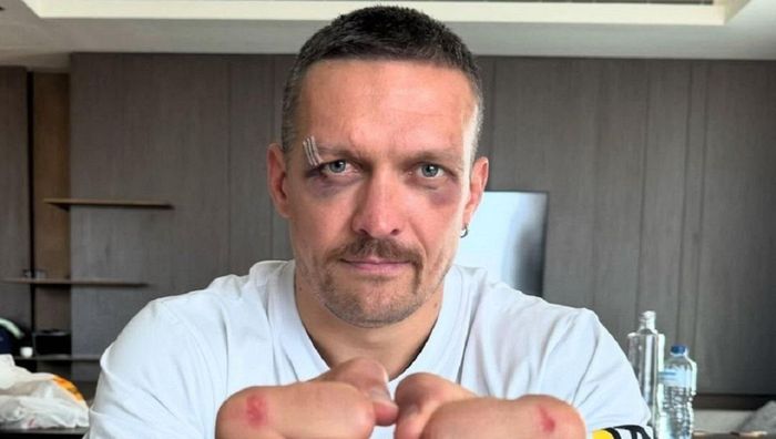 Реванш Усик – Ф'юрі: Хірн назвав часові рамки реваншу, апелюючи до віку боксерів