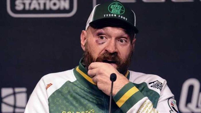 "Ф'юрі страшенно злий": екс-чемпіон світу розкрив справжню причину, чому британець завершив кар'єру